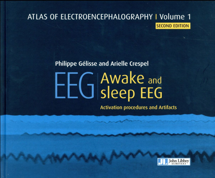 Emprunter EEG - AWAKE AND SLEEP EEG - ACTIVATION PROCEDURES AND ARTIFACTS livre