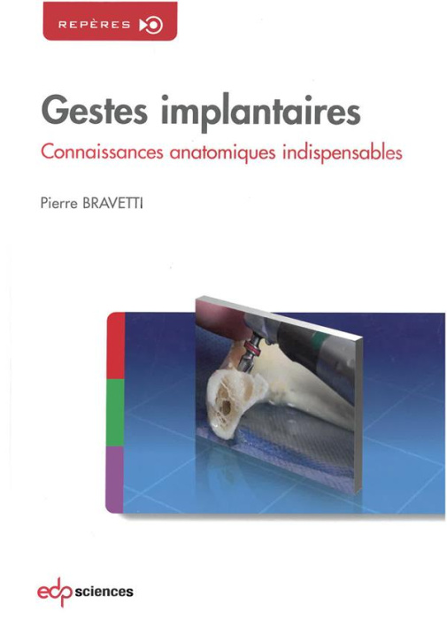 Emprunter Gestes implantaires. Connaissances anatomiques indispensables livre