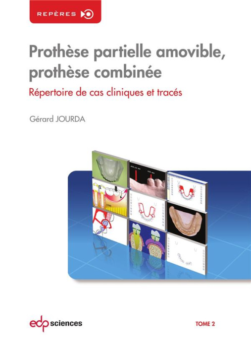 Emprunter Prothèse partielle amovible, prothèse combinée. Tome 2, Répertoire de cas cliniques et tracés livre