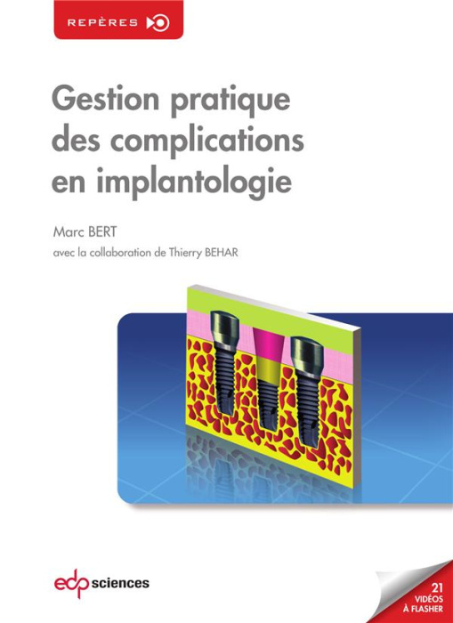 Emprunter Gestion pratique des complications en implantologie livre