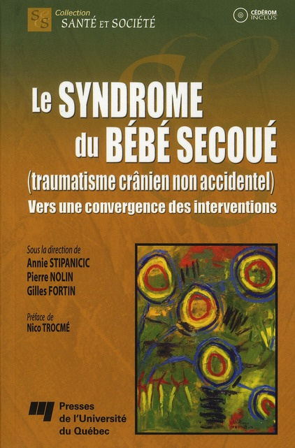 Emprunter SYNDROME DU BEBE SECOUE TRAUMATISME CRANIEN NON ACCIDENTEL livre