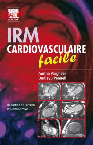 Emprunter IRM cardiovasculaire facile livre