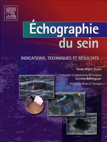 Emprunter Echographie du sein. Indications, techniques et résultats livre