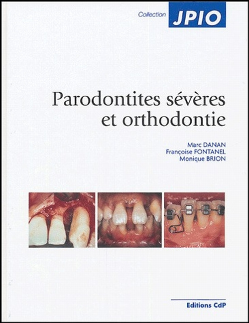 Emprunter Parodontites sévères et orthodontie livre