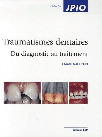 Emprunter Traumatismes dentaires. Du diagnostic au traitement livre