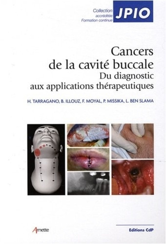 Emprunter Les cancers de la cavité buccale. Du diagnostic aux applications thérapeutiques livre