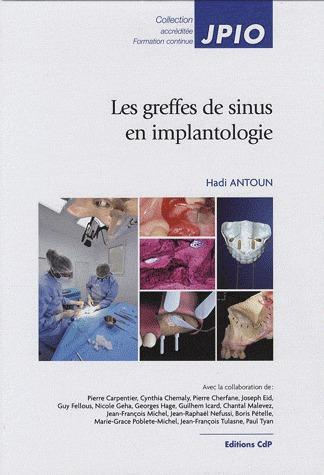 Emprunter Les greffes de sinus en implantologie livre