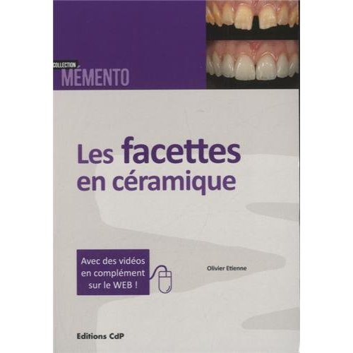Emprunter Les facettes en céramique livre