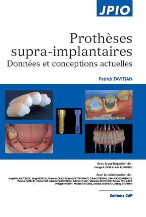 Emprunter Prothèses supra-implantaires. Données et conceptions actuelles livre