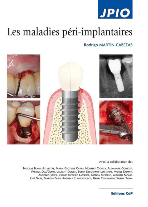Emprunter Les maladies péri-implantaire livre