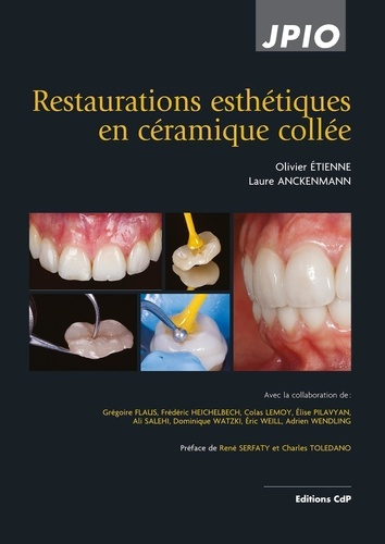 Emprunter Restaurations esthétiques en céramique collée. 2e édition livre