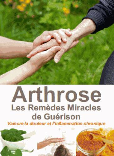 Emprunter L'arthrose, les remèdes miracles de guérison. Vaincre la douleur et l'inflammation chronique livre