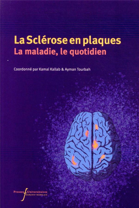 Emprunter La Sclérose en plaques. Actualités et vécu livre