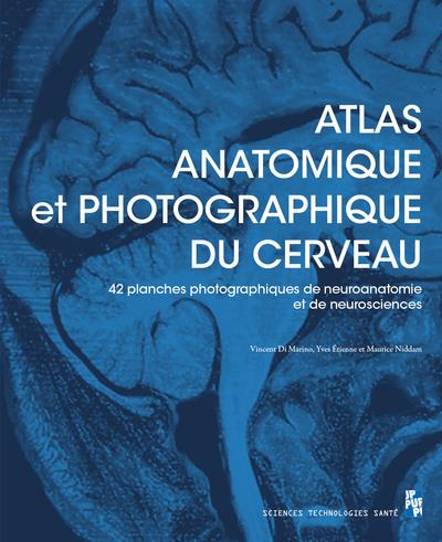 Emprunter Atlas anatomique et photographique du cerveau livre