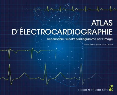 Emprunter Atlas d’électrocardiographie. Reconnaître l’électrocardiogramme par l’image livre
