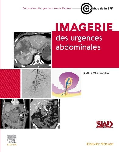 Emprunter Imagerie des urgences abdominales livre