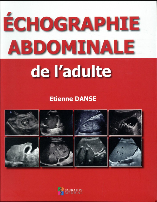 Emprunter Echographie abdominale de l'adulte livre