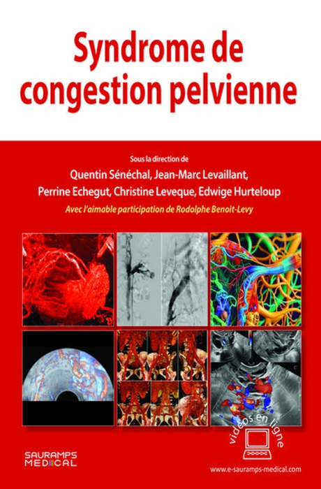 Emprunter SYNDROME DE CONGESTION PELVIENNE livre