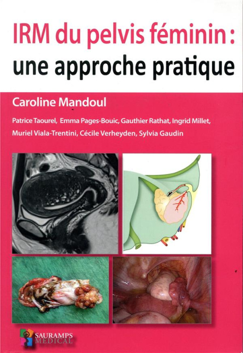Emprunter IRM du pelvis féminin : une approche pratique livre