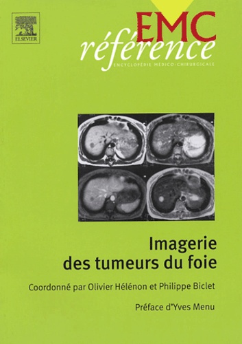 Emprunter Imagerie des tumeurs du foie livre