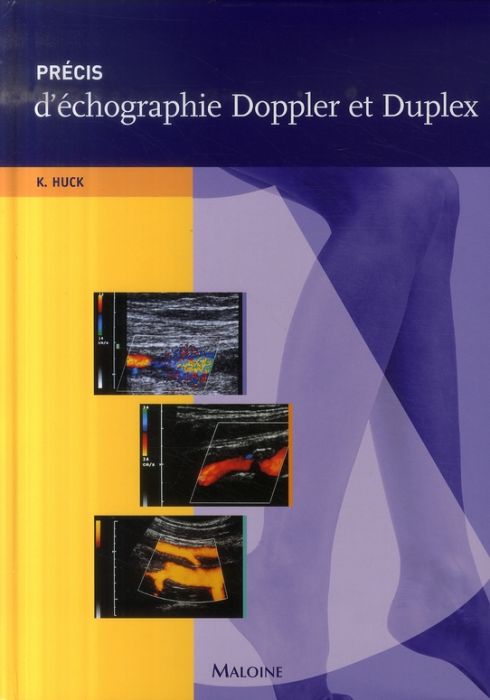 Emprunter Précis d'échographie Doppler et Duplex livre