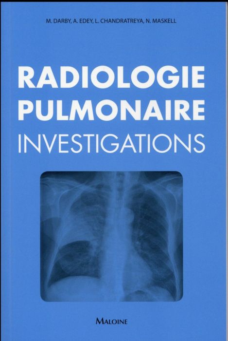 Emprunter Radiologie pulmonaire : investigations livre
