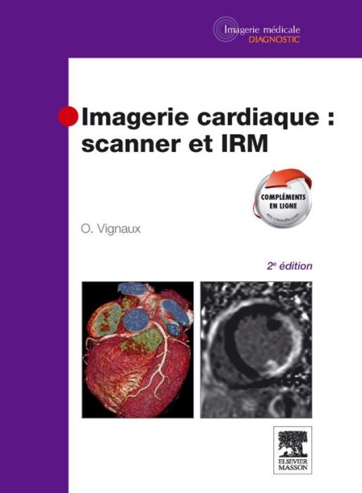 Emprunter Imagerie cardiaque : scanner et IRM. 2e édition livre