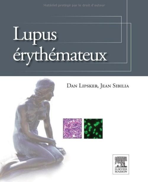Emprunter Lupus érythémateux livre