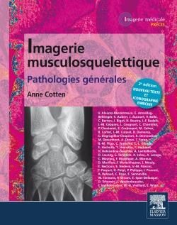 Emprunter Imagerie musculosquelettique. Pathologies générales, 2e édition livre