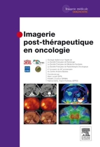 Emprunter Imagerie post-thérapeutique en oncologie livre