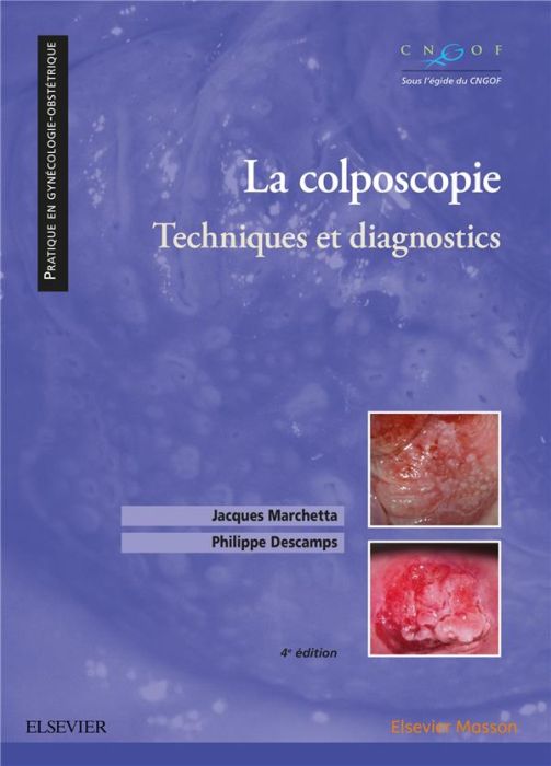 Emprunter La colposcopie. Techniques et diagnostics, 4e édition livre