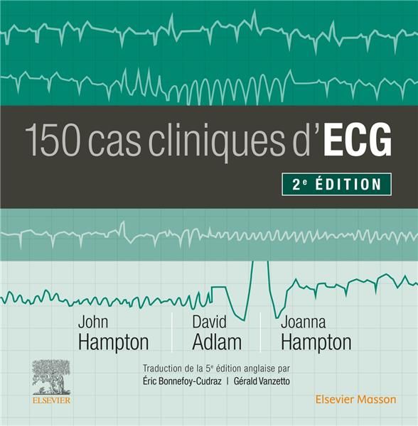 Emprunter 150 cas cliniques d'ECG. 2e édition livre