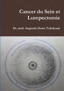 Cancer du Sein et Lumpectomie - Tchokonté Dr. med. augustin denis