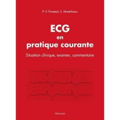 ECG en pratique courante. Situation clinique, examen, commentaire - Ennezat Pierre-Vladimir - Maréchaux Sylvestre - Iv