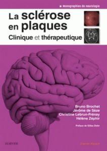 La sclérose en plaques. Clinique et thérapeutique - Brochet Bruno - Sèze Jérôme de - Lebrun-Frénay Chr