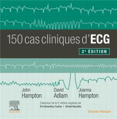 150 cas cliniques d'ECG. 2e édition - Hampton John R. - Adlam David - Hampton Joanna - B
