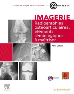 Radiographies ostéoarticulaires. Eléments sémiologiques à maitriser - Cotten Anne