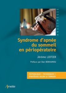 Syndrome d'apnée du sommeil en périopératoire - Liotier Jérôme - Benhamou Dan
