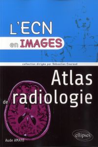 Atlas de radiologie - Amato Aude - Couraud Sébastien