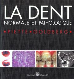 La dent normale et pathologique - Goldberg Michel - Piette Etienne