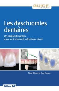 Les dyschromies dentaires. Un diagnostic précis pour un traitement esthétique réussi - Clément Marie - Marcoux Clara - Viennot Stéphane