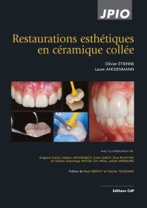 Restaurations esthétiques en céramique collée. 2e édition - Etienne Olivier - Anckenmann Laure - Balbzioui Bil