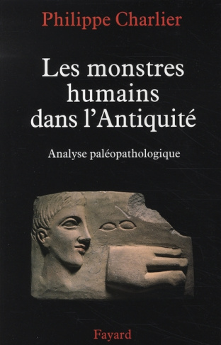 LES MONSTRES HUMAINS DANS L'ANTIQUITE - ANALYSE PALEOPATHOLOGIQUE