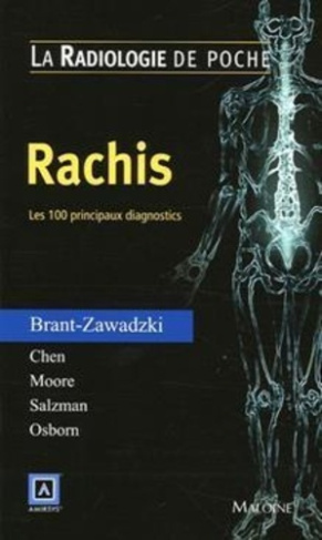 Rachis. Les 100 principaux diagnostics