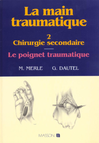 La main traumatique. Tome 2