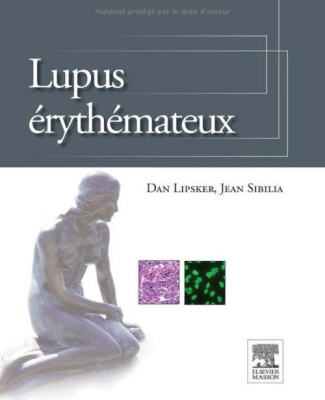 Lupus érythémateux