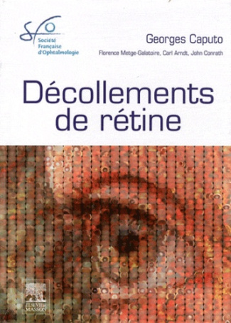 Décollements de rétine. Rapport 2011