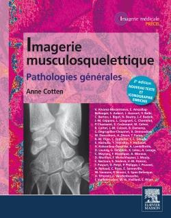 Imagerie musculosquelettique. Pathologies générales, 2e édition