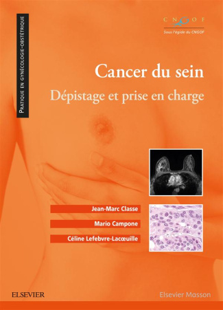 Cancer du sein. Dépistage et prise en charge