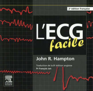 L'ECG facile. 2e édition